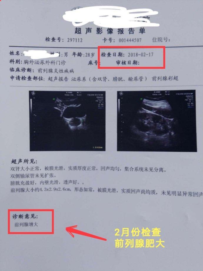 b超可以医保卡报销吗 前列腺b超可以医保卡