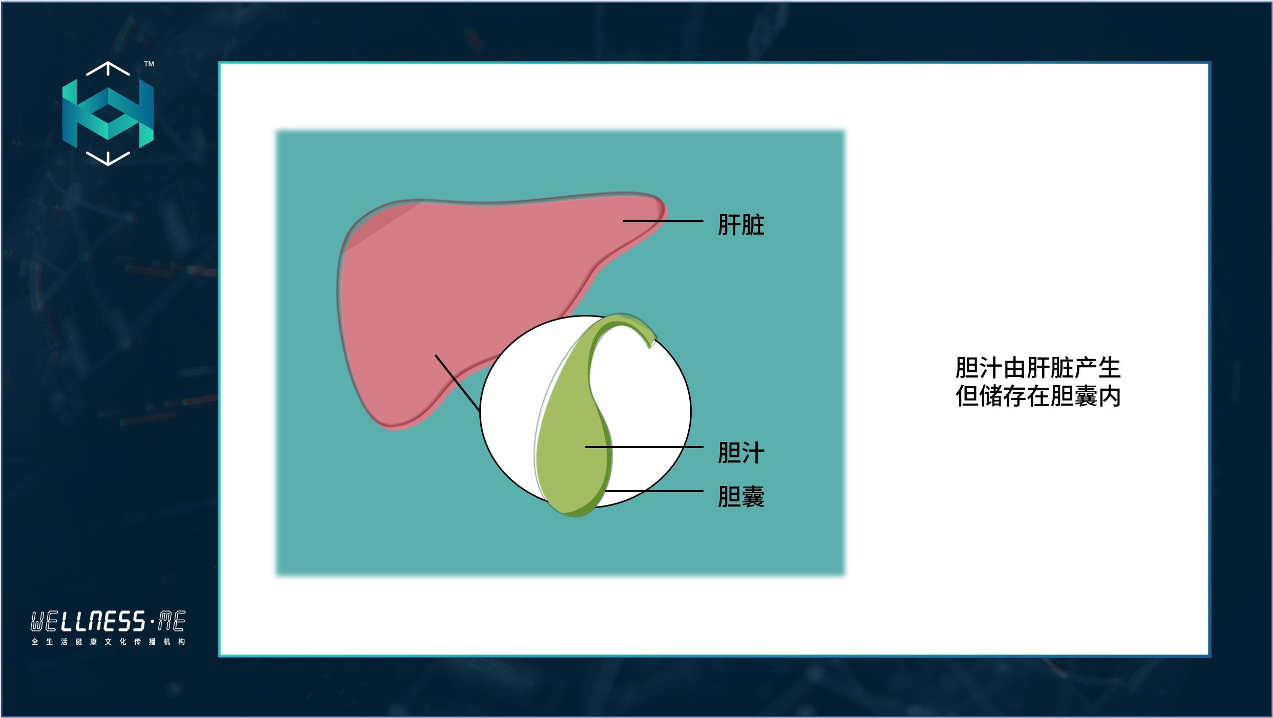 胆结石真的是不吃早饭的锅