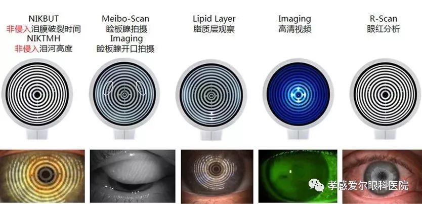 干眼黑科技眼表综合分析仪落户孝感爱尔眼科医院