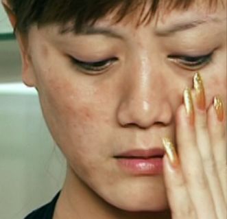 黑色素无法正常代谢排出,营养无法输送给表皮细胞造成皮肤暗沉无光泽