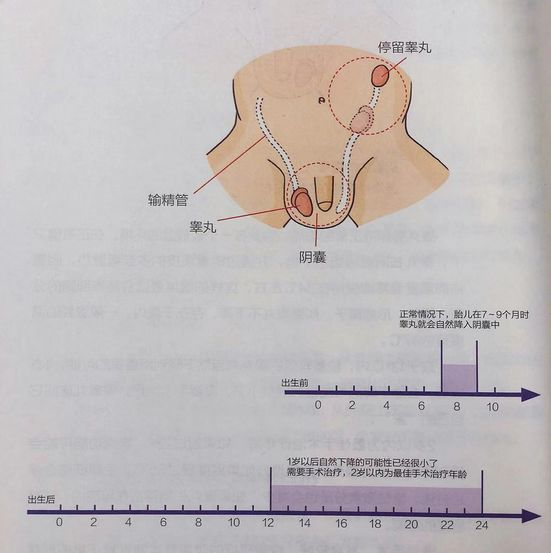                     家有男宝必看！包皮割不割？多大割？怎么清洁？这些事儿别乱来