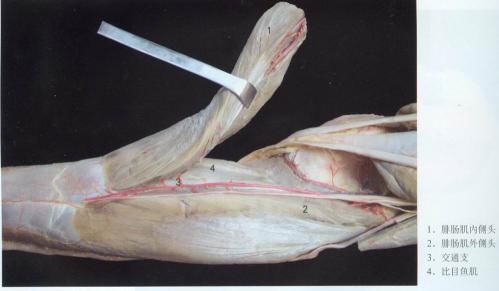 比目鱼肌(深层肌) 起点:胫腓骨后面 止点:与腓肠肌合成肌腱,止于跟骨