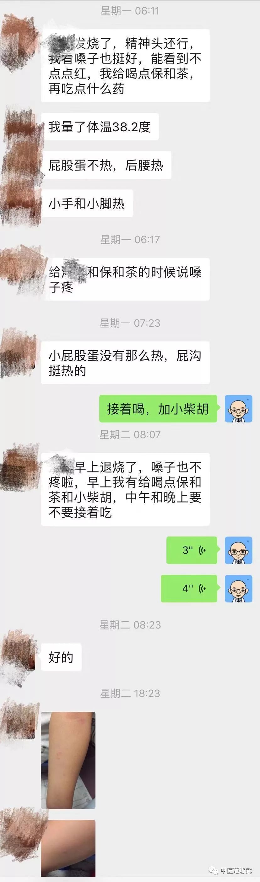 退烧后湿疹怎么办