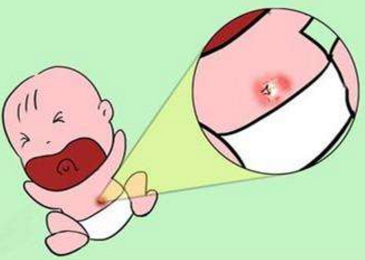                     胎儿出生“剪脐带”时，胎儿疼还是妈妈疼？答案让人有点意外！
