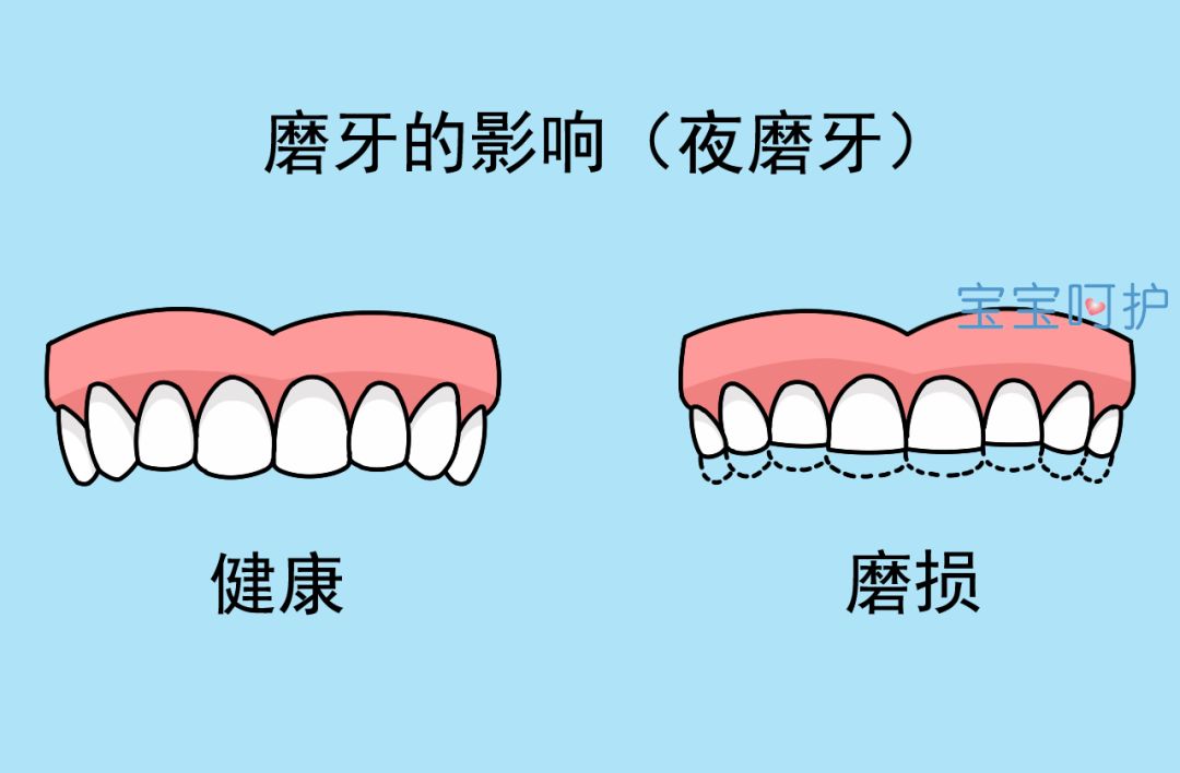                    宝宝经常磨牙要去医院吗？看完再做决定也不迟