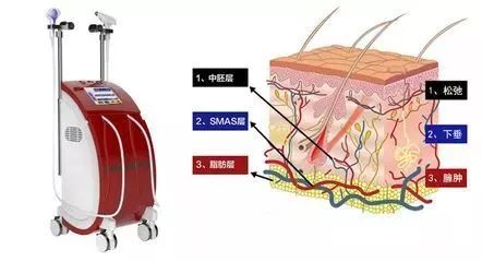 热拉提的原理_抗衰紧肤美容仪器好用吗 绿美涵 惠州抗衰紧肤美容仪器