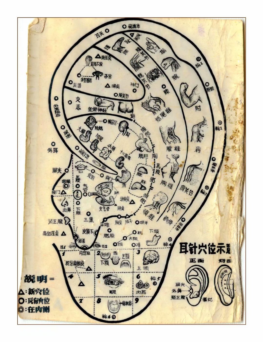 福建中医学院手绘针灸穴位图巫氏中医博物馆藏品