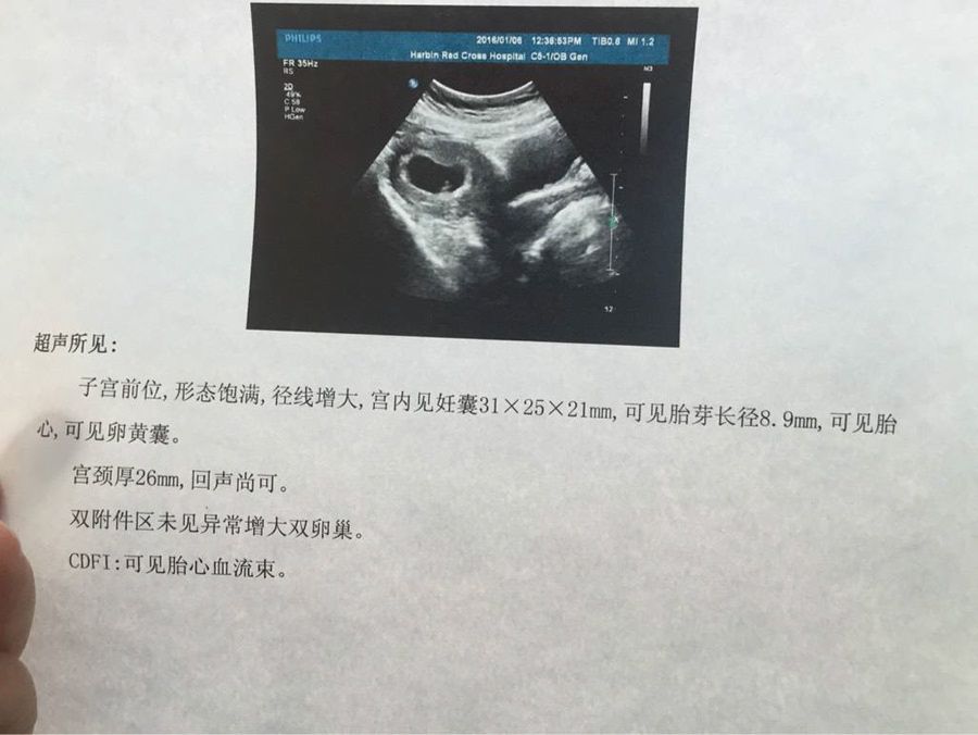                     原创            胎儿如果缺氧，会通过这些方式告诉妈妈，越早知道越好