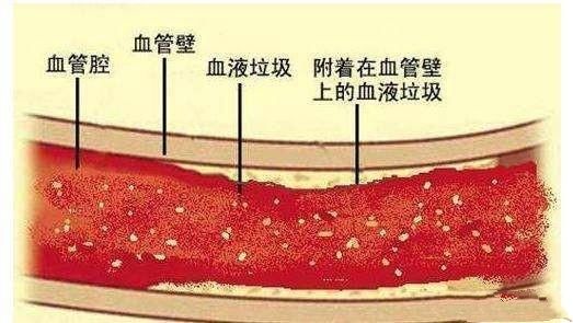 吃啥能降血脂胆固醇 132d094bcbdd49d4bfcc967fd5b63ae4.jpeg