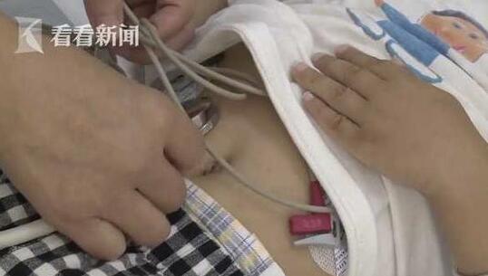                     家长要当心 2岁男童咬碎体温计后误吞水银