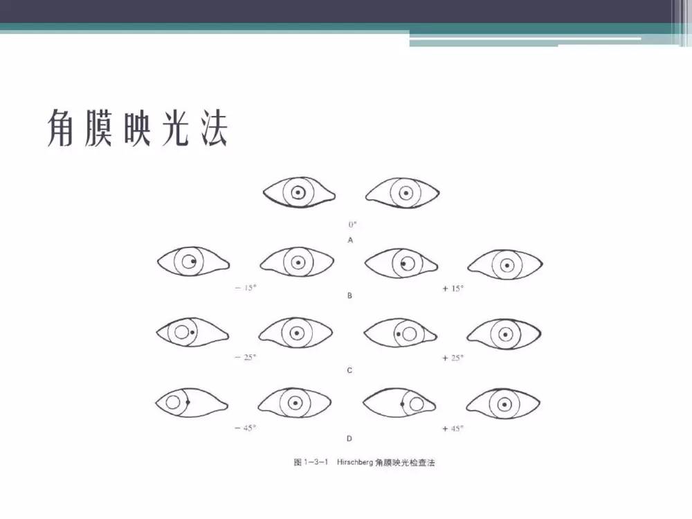 角膜映光法比较适用,它是一个检查显性共转性斜视的粗略法,其方法是在