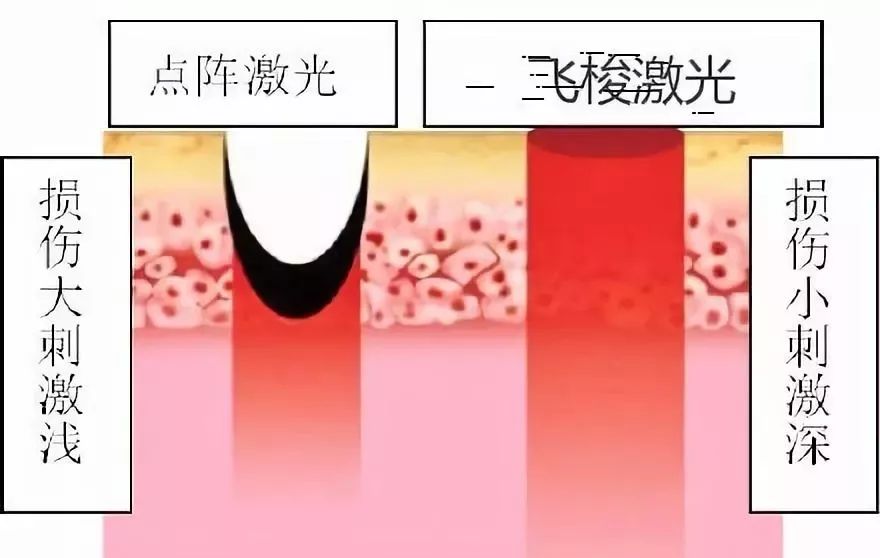 icon飞梭青春很美别因痘印追悔