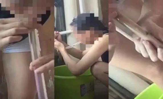                     为了瘦，这些孩子把塑料管插进胃里