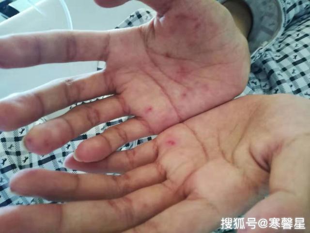                     重症孙子30天花23万，爷爷果断拒救：我有4个孙子不差这一个