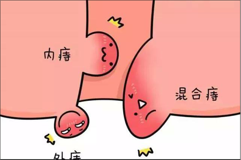 痔疮,你不认识一下?——深圳市中医肛肠医院