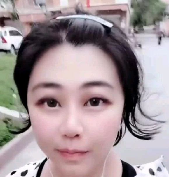 乔碧萝事件反转!采访时称自己是90后,像大妈因脸部过敏致浮肿