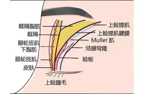 从眼眶结构上看,欧洲人睁眼时,在双眼皮褶皱下方也就是睑板前没有