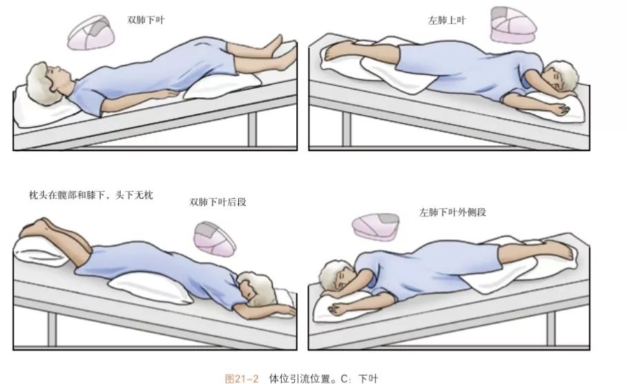 左侧在上,右侧在下,倾斜 15 ～ 30°,同时取头低足高位,抬高床尾,并