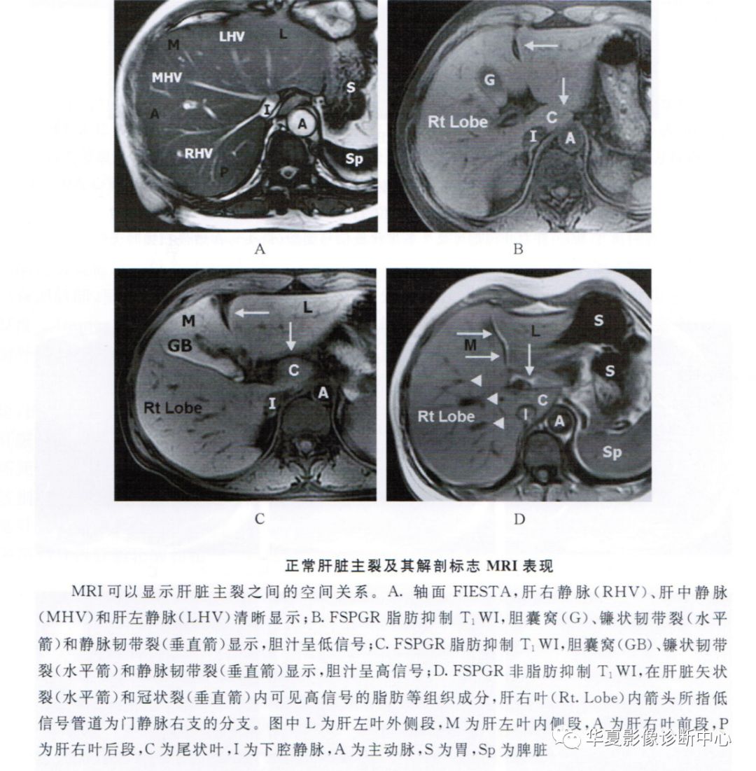 E诊断：肝脏部位CT诊断笔记-搜狐