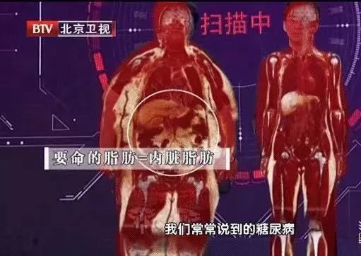 有的人明明不胖,却有鼓鼓的小肚腩~小心背后的健康问题!_脂肪