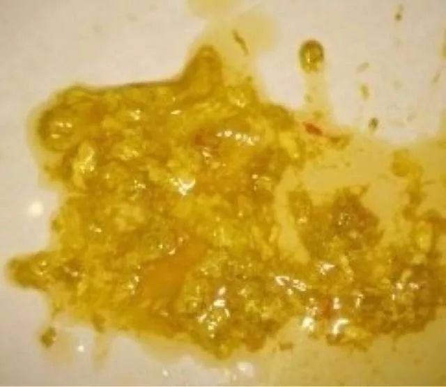                     宝宝腹泻不用止，你只需要做好这件事就可以