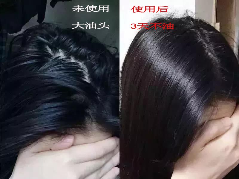 时尚 美容 只要头发油腻bia在头皮上, 你的优雅美丽, 在你出现在人们