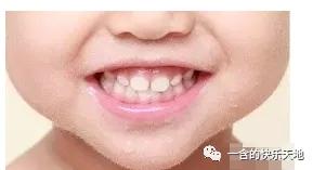                     准妈妈不补钙 宝宝牙齿很糟糕