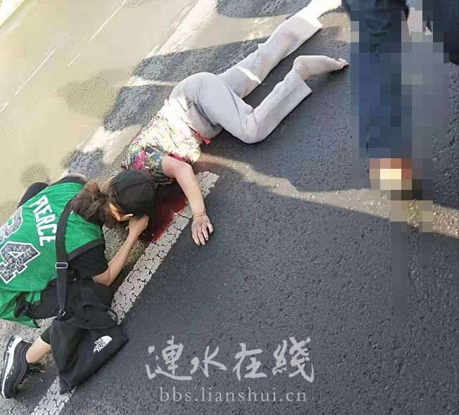 突发:老奶奶遭车祸流血不止,中医院陆明娇出手相救