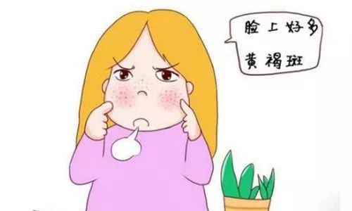 您不得不知道的黄褐斑基本知识点