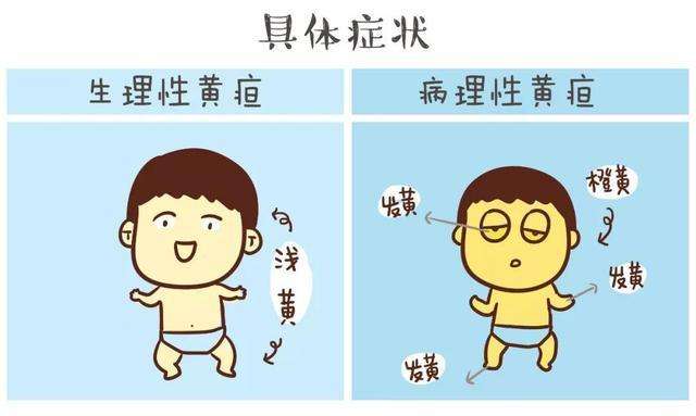 怎么晒黄疸 989bac959cd7467a9af8ab65822fcad7.jpeg