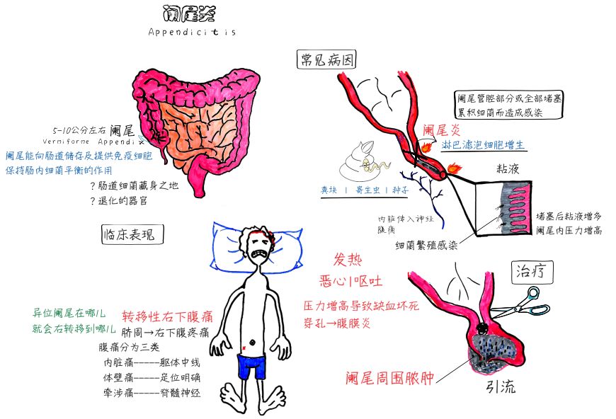 如不治疗,死亡率会很高,主要原因是因为会引致腹膜炎,门静脉炎和感染