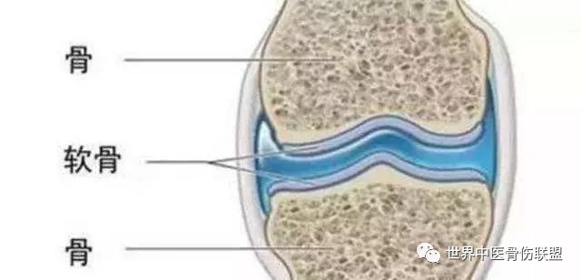 骨科大夫教你搞定膝关节炎_软骨