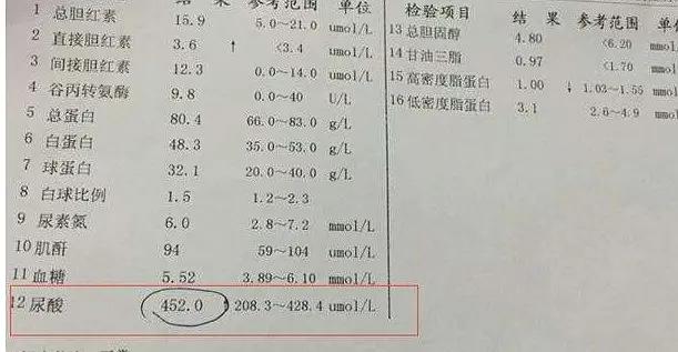 尿酸高是如何形成的,尿酸高有哪些症状?