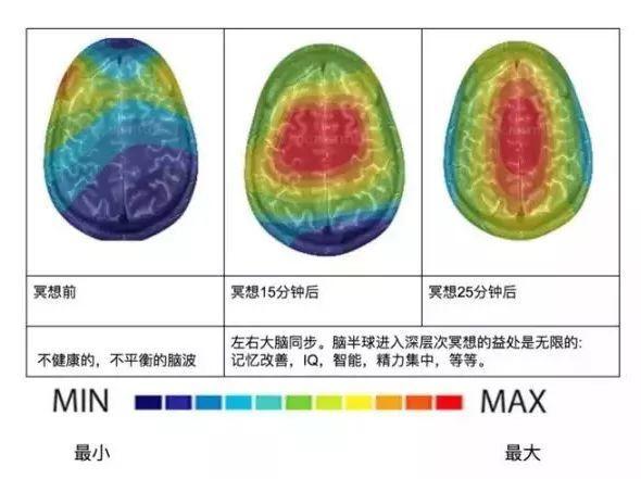 大脑在冥想前后同步过程示意图