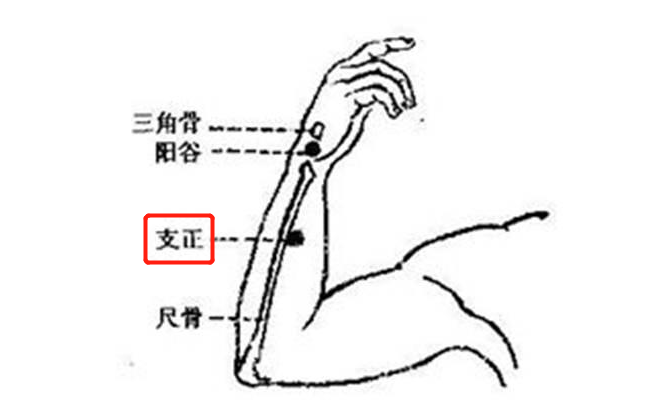 手太阳小肠经之支正穴,祛赘生物(如瘊子,扁平疣,脂肪瘤.