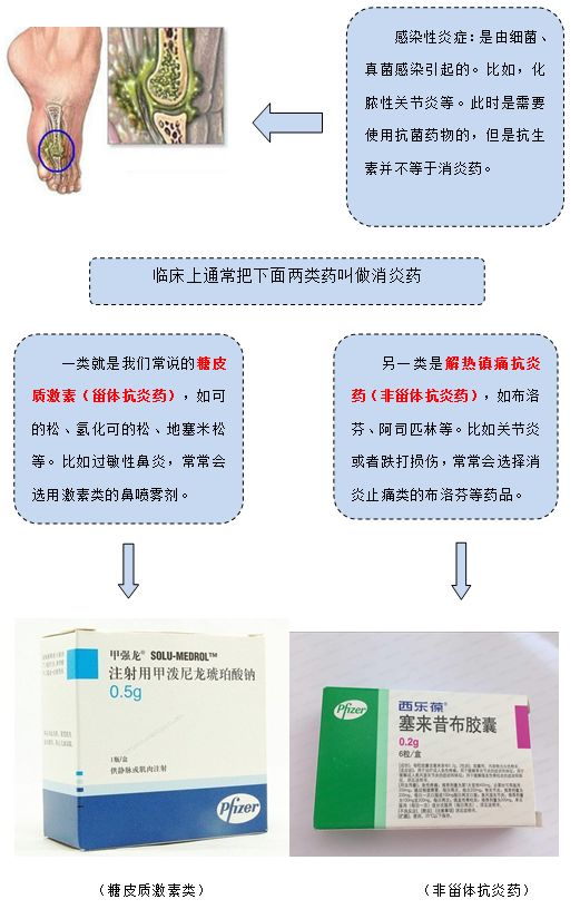 骨科消炎抗生素or消炎药