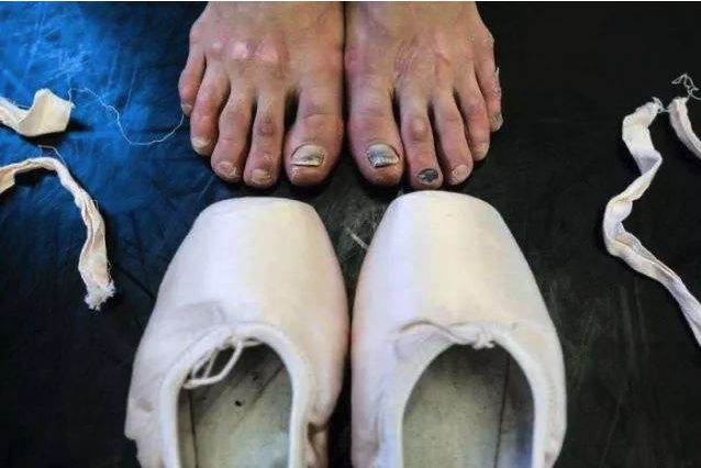 怒减20斤,堪比整容:世界真的会狠狠奖励,瘦下