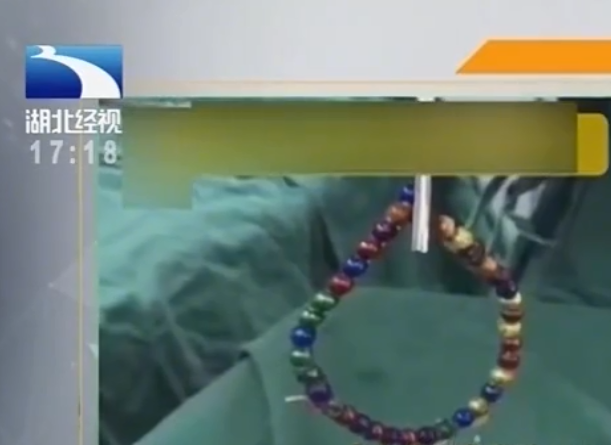 磁力珠误食 d9ea20d3fc304e4eb3b748b506fab5b7.png