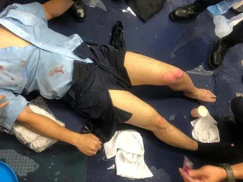 起底香港乱局由来和本质 激进势力究竟意欲何为？