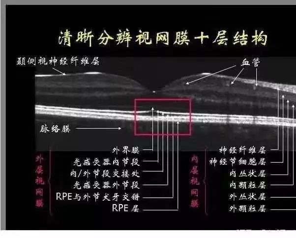 眼科检查项目oct