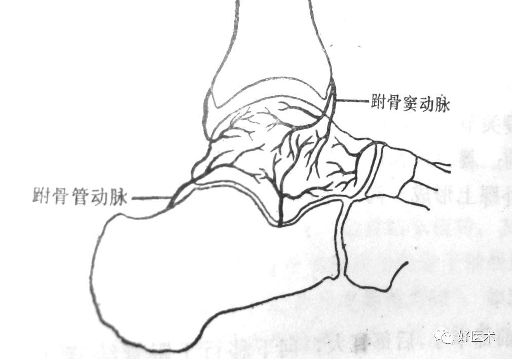 距骨骨折的治疗方法全解析,值得一看!