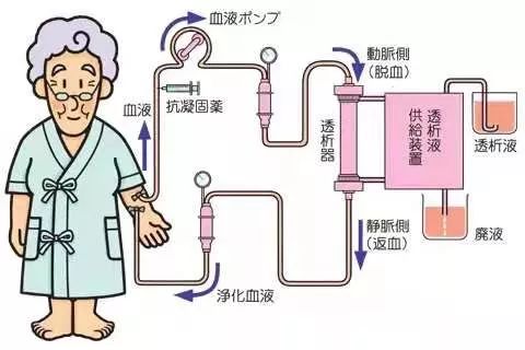 医院动态杏林春暖省二中医院专家助您了解透析患者的生命线