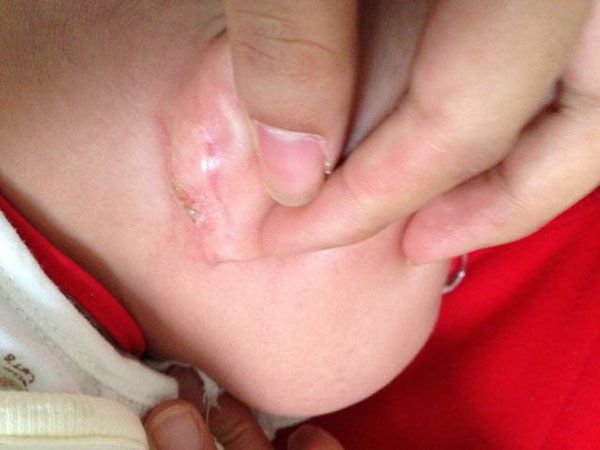                     原创            孩子的这几个地方不能过分清洗，家长不注意就会出问题