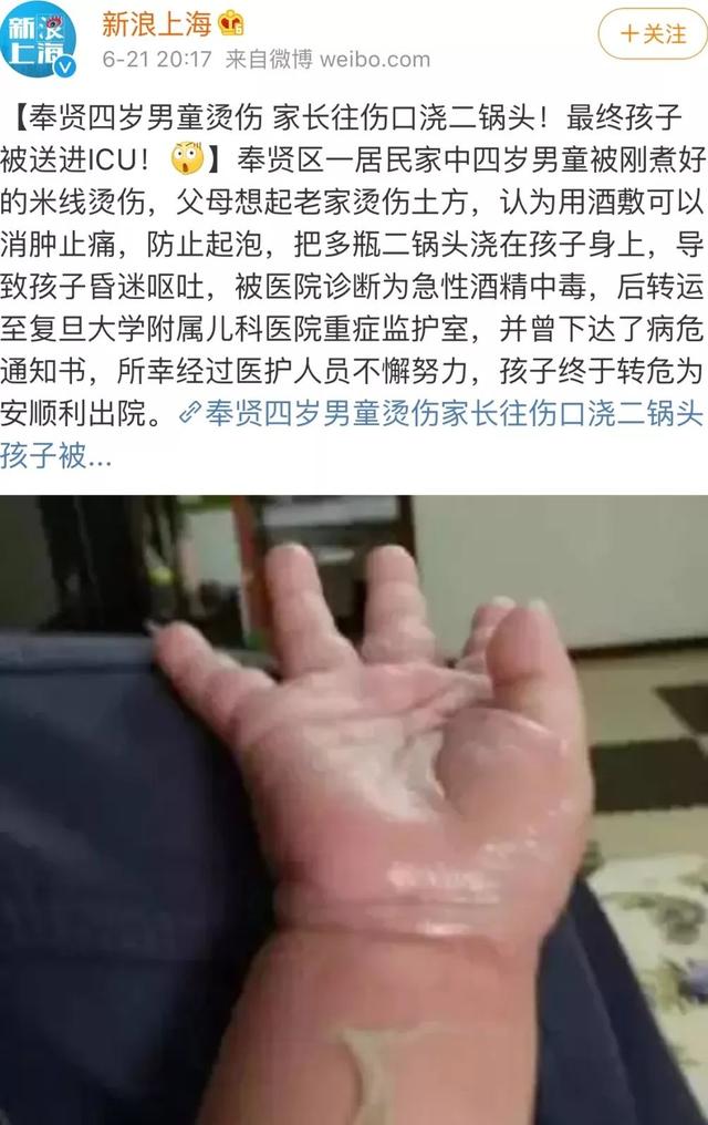                     夏天的这些隐形烫伤“杀手”，你注意到过吗？