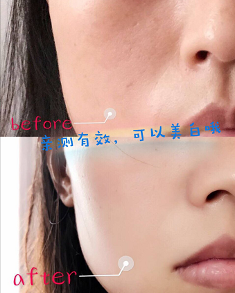 怎么让脸部皮肤变得细腻光滑 49a34767067943af9155b1124100e539.png