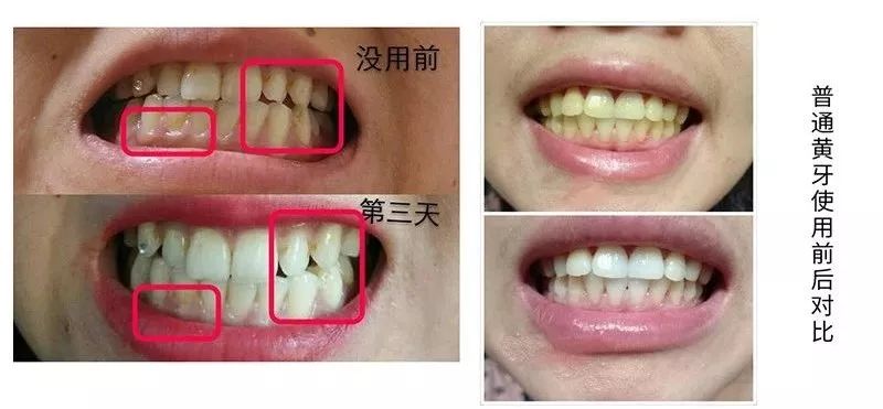 怎么刷白牙最快 5ceaa2c33b5f4affade04b79b6ad2f73.jpeg