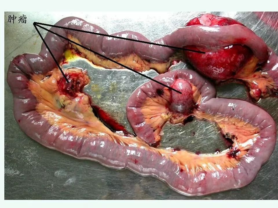 胃肠道间质瘤的ct诊断丨影像天地