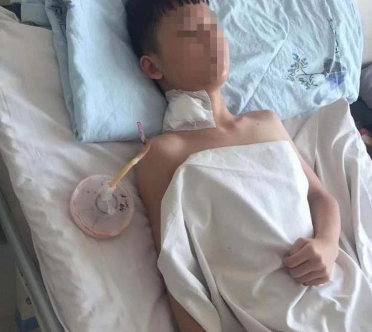                     原创            大风吹起路边电箱玻璃，男孩险遭割颈：谁该为受伤的孩子负责？