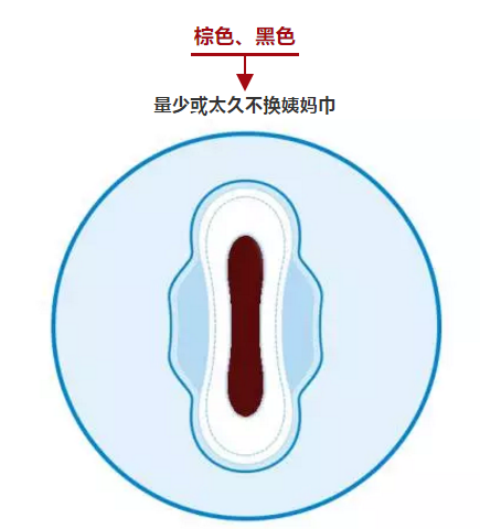 当经量过少时，整个经期中的经血为咖啡色，甚至接近黑色，这是一个应该