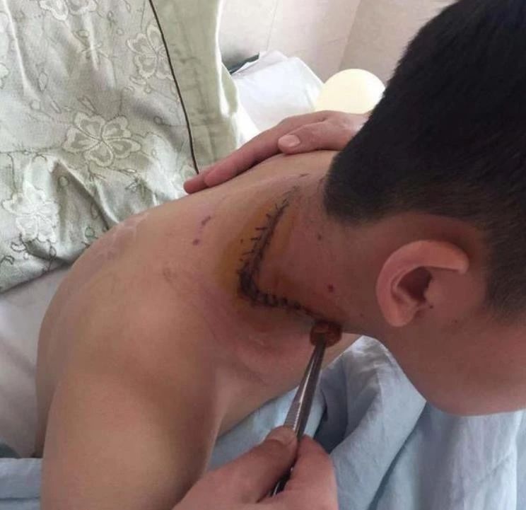                     原创            大风吹起路边电箱玻璃，男孩险遭割颈：谁该为受伤的孩子负责？